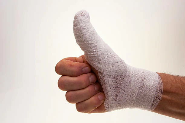 New Rehabilitation Exercises for Mallet Finger Bring Hope to Patients