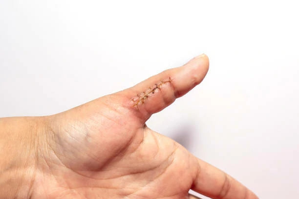 Introducing Middle Finger Exercises for Enhanced Dexterity and Hand Health