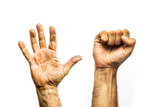 Introducing the Ultimate Rehabilitation Solution: Mallet Finger Exercises Video