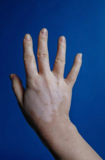 Chinese Finger Weakness Exerciser